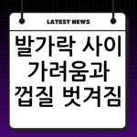 발가락 사이 가려움과 껍질 벗겨짐, 놓치기 쉬운 무좀 초기증상 thumbnail