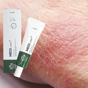 건조한 피부 건선 가려움증 간지러움 땀띠 습진 연고 크림, 20ml, 1개