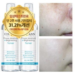 기미 잡티 주근깨 미백 색소침착 착색 검버섯 수분 보습 화이트닝 광채 기미잡티 미스트, 2개, 150ml