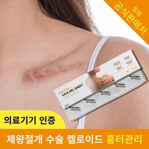 의료기기 힐텀 시카 겔 시트 흉터 관리 실리콘 겔 밴드, 1개, 1개입